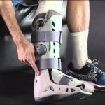Foot Braces